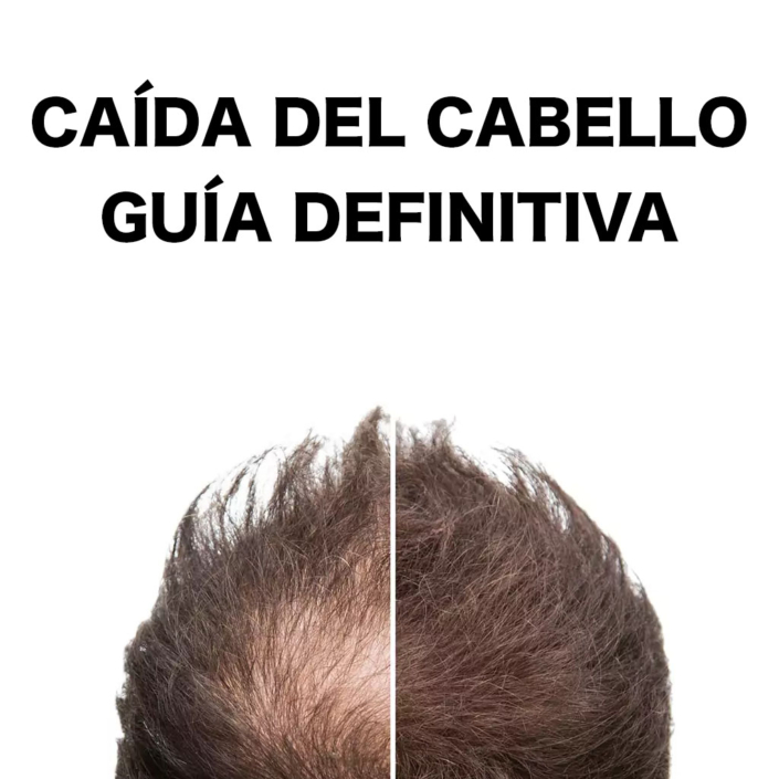 Caída del cabello. Guía definitiva
