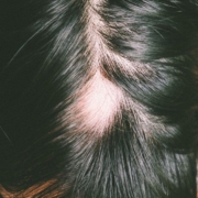 Caída del Cabello por Estrés: La Guía COMPLETA 2025 para Recuperar tu Pelo 🥇 7 Caída del Cabello por Estrés